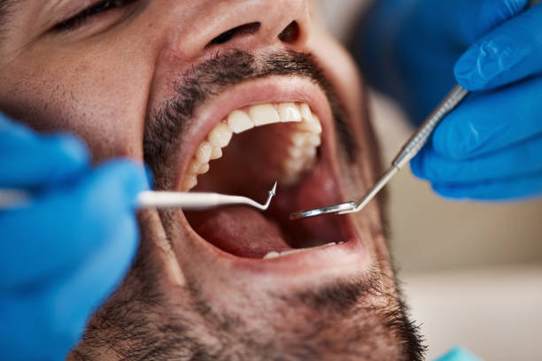 Best Emergency Dental Care for Broken or Chipped Teeth in Swedesboro, NJ
