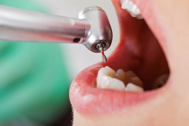 Best Emergency Treatment for Dental Infections or Abscesses in Swedesboro, NJ